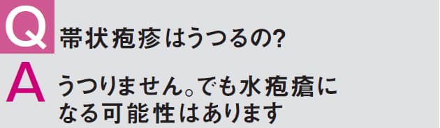 帯状疱疹 アラセナs 帯状疱疹に市販薬の塗り薬を使ってもいい？ゲンタシンやリンデロンも薬局で買える？