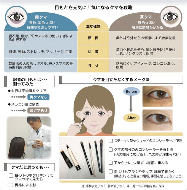 目のクマ 青 は血流改善 茶 はメークで対応 Nikkei Style