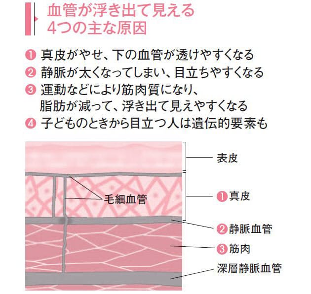 手の甲に浮き出た血管 レーザー治療できれいに Nikkei Style 手の甲に浮き出た血管 レーザー治療できれいに Nikkei Style