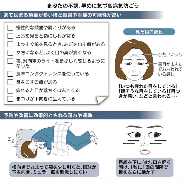 頭痛の原因がまぶたに 垂れてきたら要注意 Nikkei Style