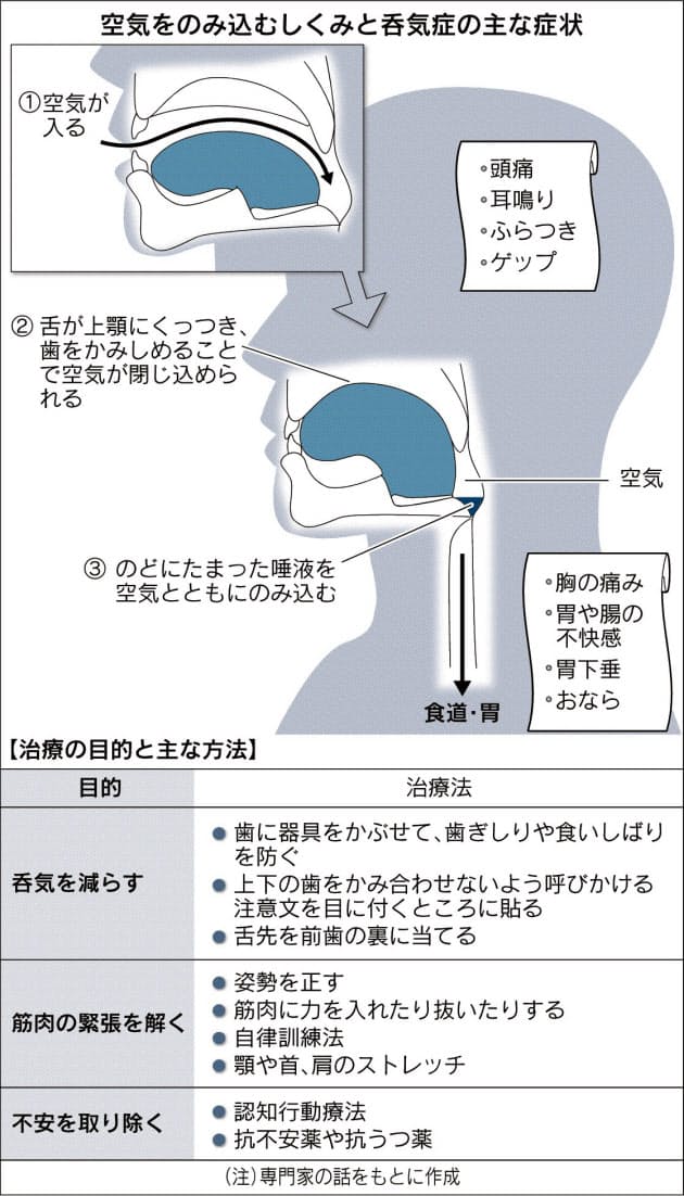 ゲップ おならで悩んだら 呑気症 歯科での治療も Nikkei Style