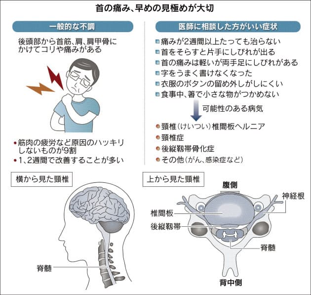 首の痛み 手足にしびれ要注意 適度な運動を Nikkei Style