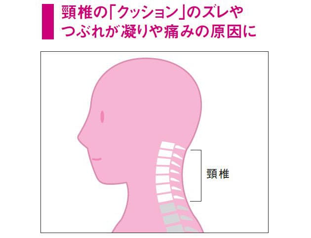 首の痛みを誘発 危険なスマホの あご突き出し Nikkei Style 首の痛みを誘発 危険なスマホの あご突き出し Nikkei Style