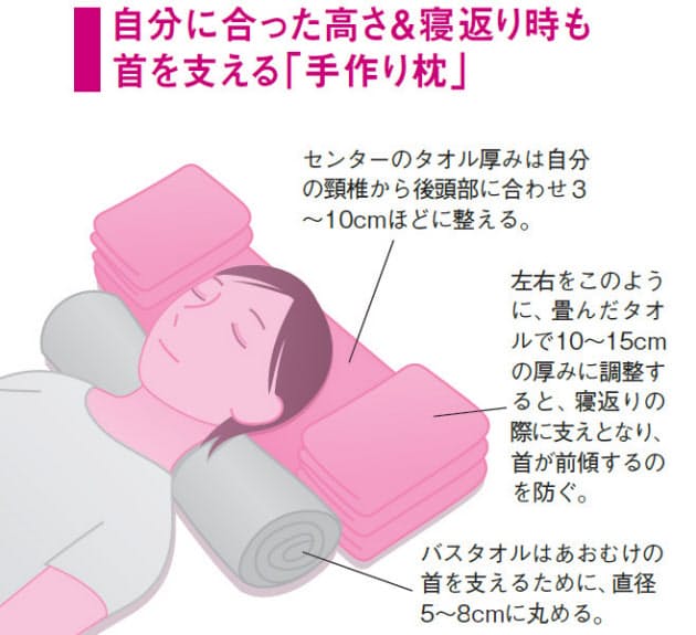 首の痛み 受診の見極めは しびれ の有無 Nikkei Style