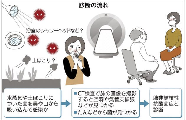 ブログ 抗 非 酸 症 性 菌 結核 検査結果は改善していました！