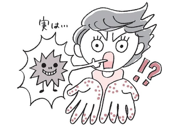 汗疱が悪化したら皮膚科へ ステロイド塗り保湿 Nikkei Style 汗疱が悪化したら皮膚科へ ステロイド塗り保湿 Nikkei Style
