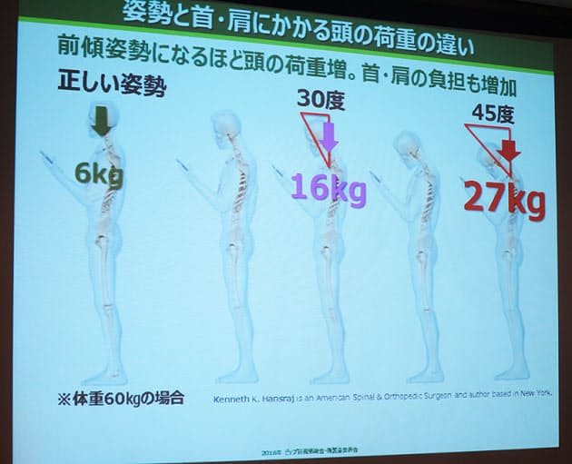 急増中の W荷重肩凝り モバイル機器に注意せよ Nikkei Style 急増中の W荷重肩凝り モバイル機器に注意せよ Nikkei Style