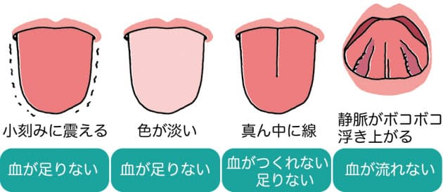 舌で分かる血流不足 目指すはサラサラよりタップリ Nikkei Style
