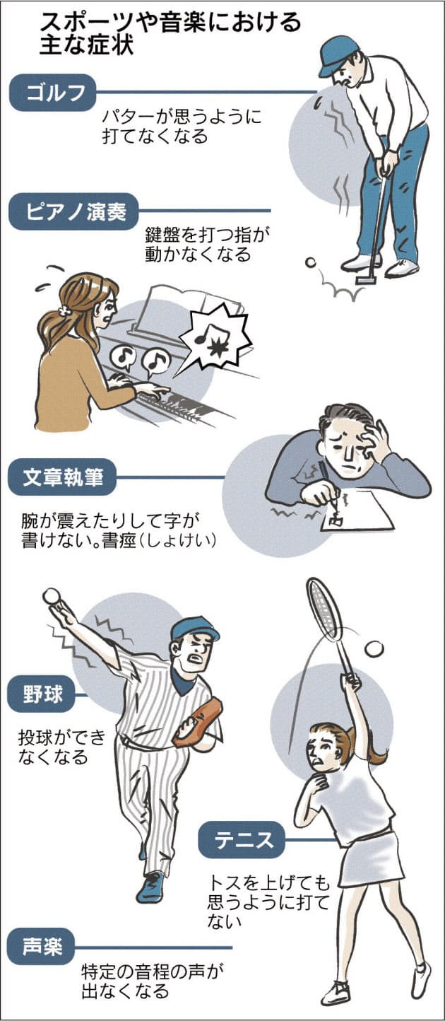 プロ選手 演奏家 突然手が動かなく イップスを知る Nikkei Style プロ選手 演奏家 突然手が動かなく イップスを知る Nikkei Style