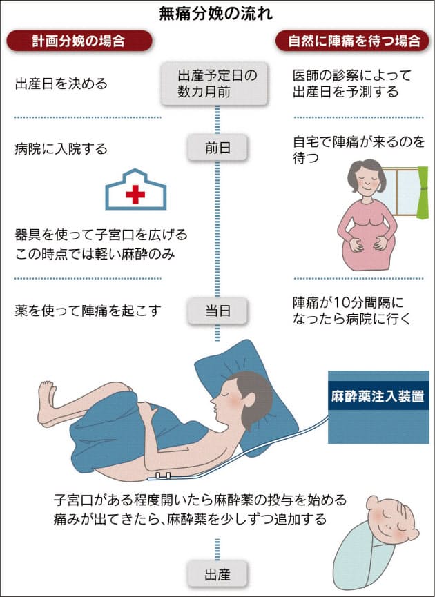 無痛 分娩 と は