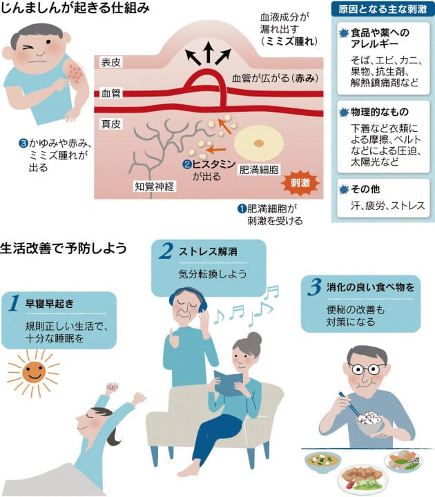 皮膚にプツプツじんましん かゆみは冷やして抑える Nikkei Style 皮膚にプツプツじんましん かゆみは冷やして抑える Nikkei Style