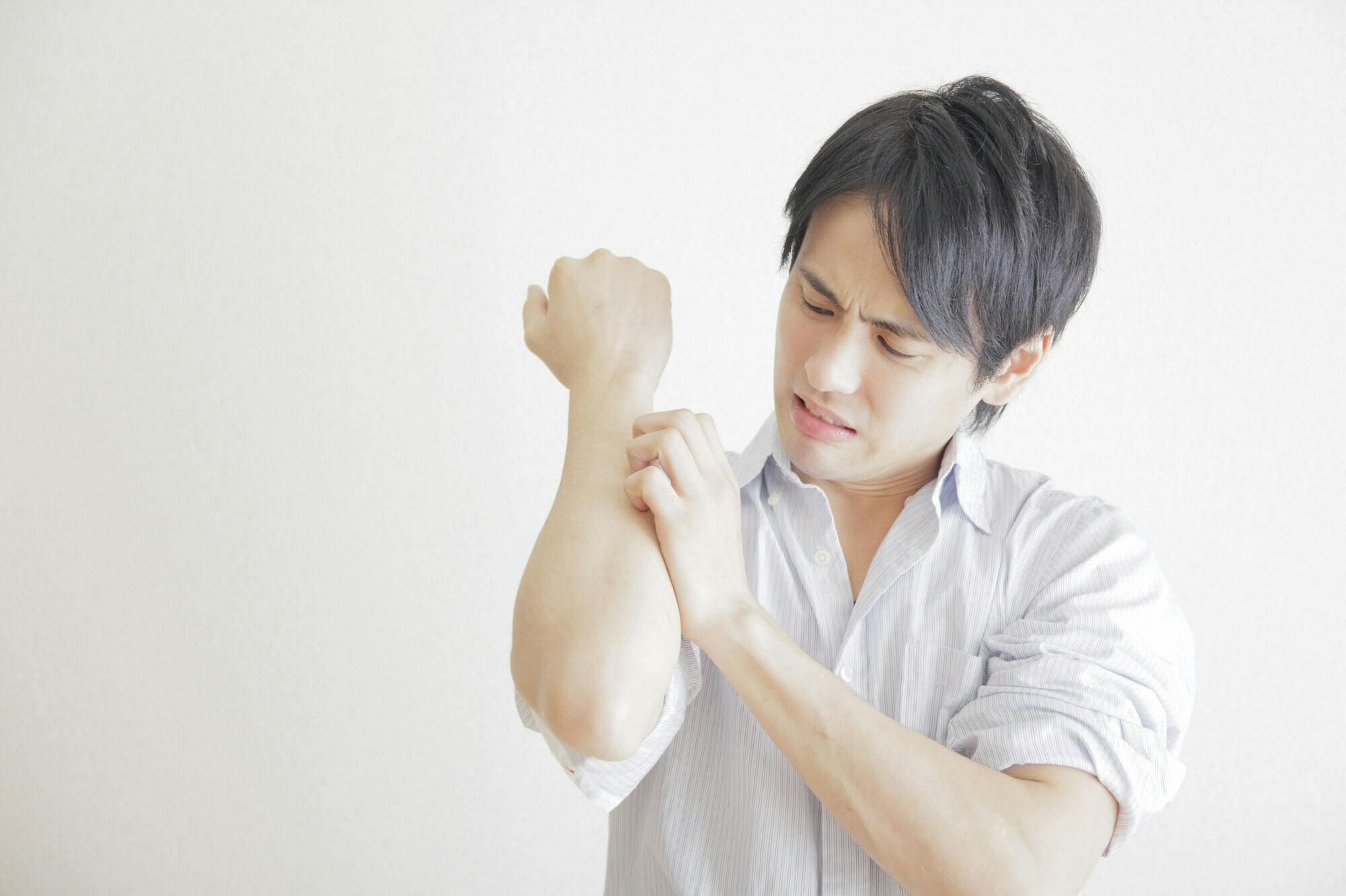 皮膚にプツプツじんましん かゆみは冷やして抑える Nikkei Style 皮膚にプツプツじんましん かゆみは冷やして抑える Nikkei Style