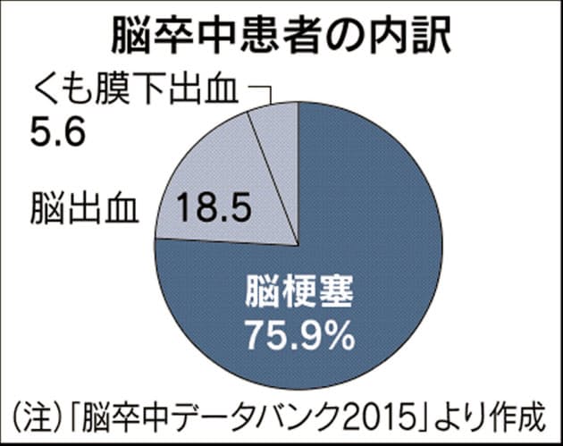 脳梗塞 時間が勝負 血栓溶解 回収すぐ見極め Nikkei Style 脳梗塞 時間が勝負 血栓溶解 回収すぐ見極め Nikkei Style