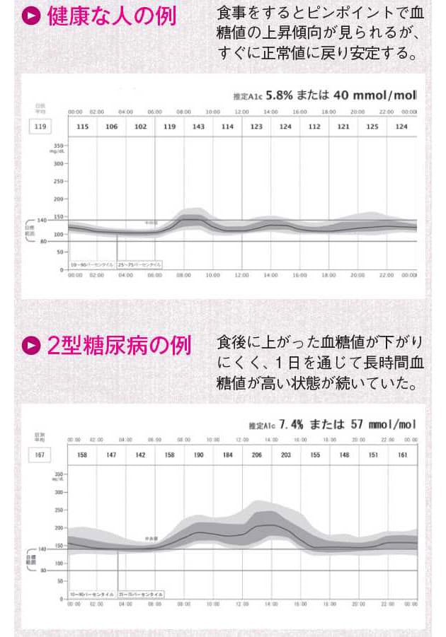 痛くない新型血糖測定器 腕にセンサーをつけるだけ Nikkei Style