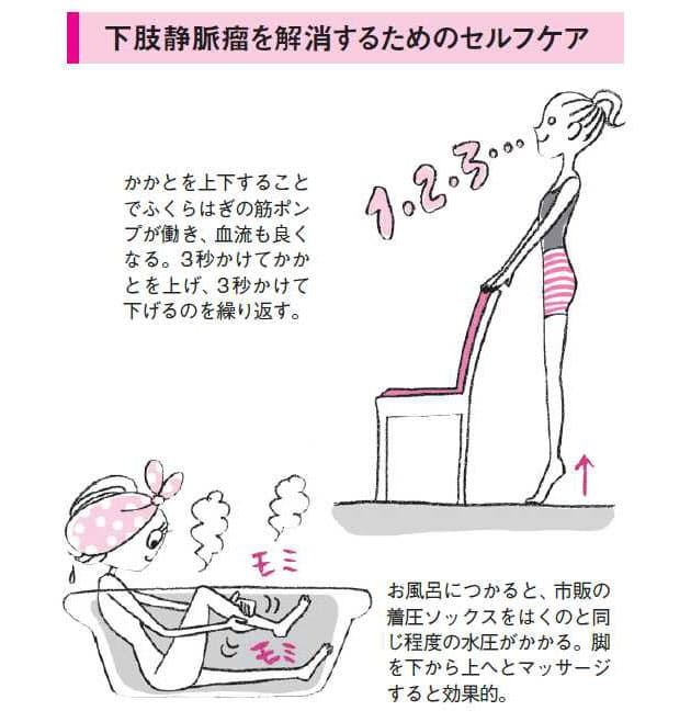 かかとの上げ下げが効果的 下肢静脈瘤のセルフケア Woman Smart Nikkei Style