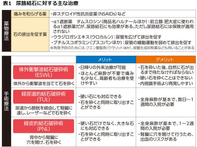なぜ夏に多い 尿路結石 予防 再発防止のポイント ヘルスｕｐ Nikkei Style