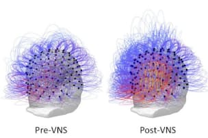 致死率30 人食いバクテリア の正体 対処法は Nikkei Style