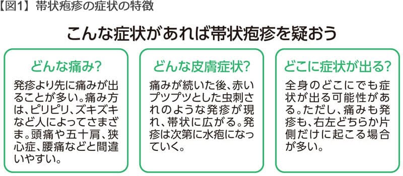 痛み 帯状 ピーク 疱疹 帯状疱疹の痛みのピークはいつまで？治っても痛みは残るの？