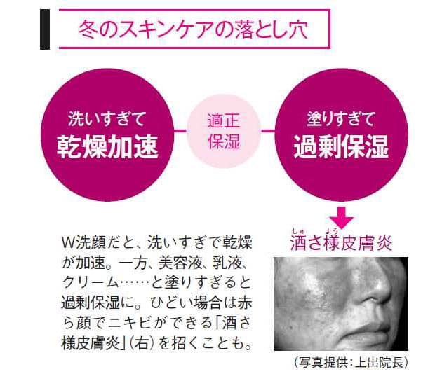 洗いすぎ 保湿しすぎは逆効果 冬の肌トラブル対策 Nikkei Style
