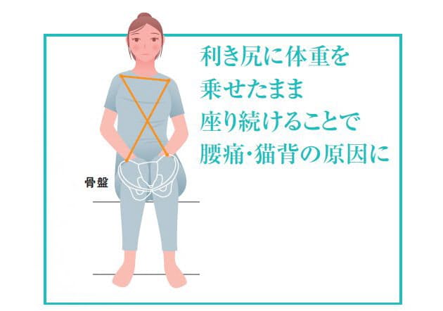 腰痛の原因は 利き尻 痛くならない座り方 立ち方 Nikkei Style