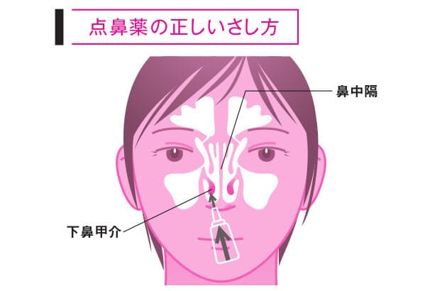 根治療法の 舌下免疫療法 は3 5年 花粉対策 基本はステロイド点鼻薬 子供でもok Nikkei Style