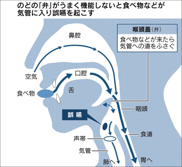 誤嚥性肺炎から高齢者守れ 料理 発声でリスク減 Nikkei Style
