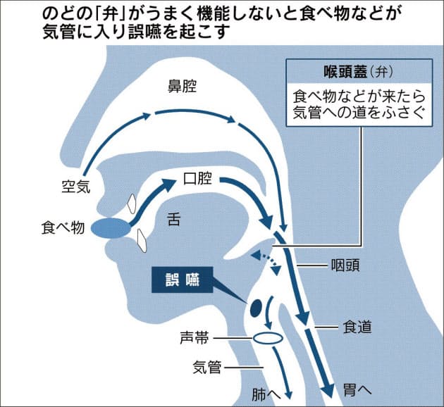 誤嚥性肺炎から高齢者守れ 料理 発声でリスク減 Nikkei Style 誤嚥性肺炎から高齢者守れ 料理 発声でリスク減 Nikkei Style