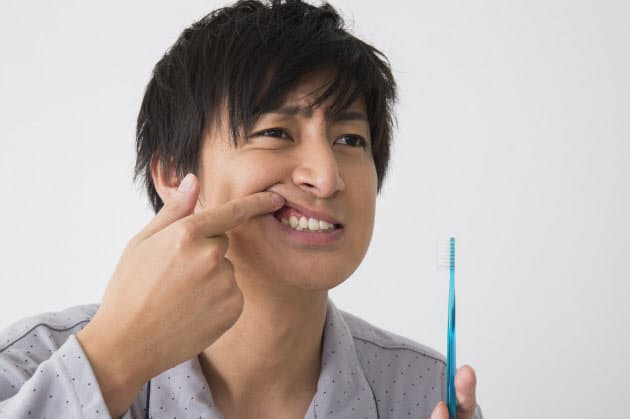 歯周病 知らぬ間に進行 成人の半数が予備軍 Nikkei Style