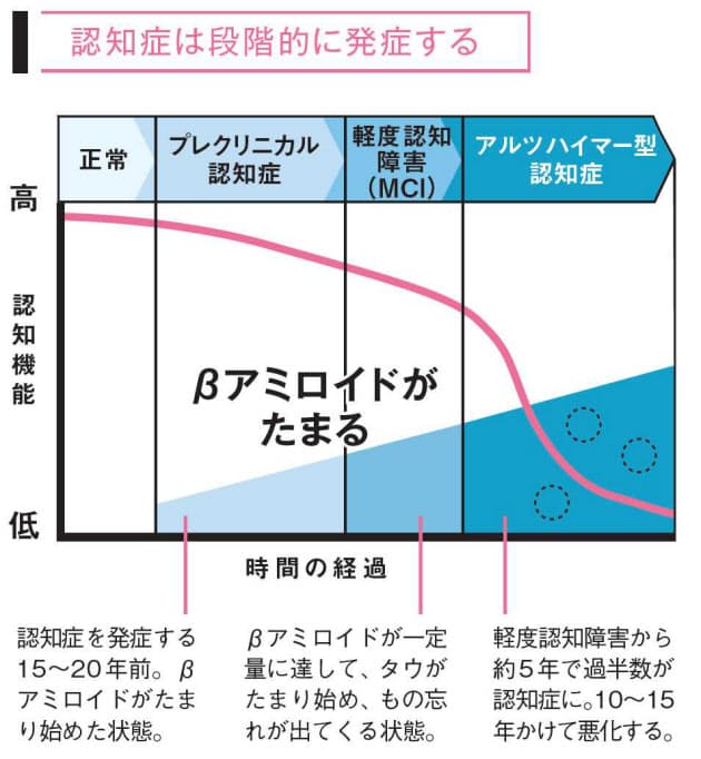 急速なもの忘れ 脳血管性の可能性あり 認知症の原因は脳のゴミ 40代なら知るべき Nikkei Style 急速なもの忘れ 脳血管性の可能性あり 認知症の原因は脳のゴミ 40代なら知るべき Nikkei Style