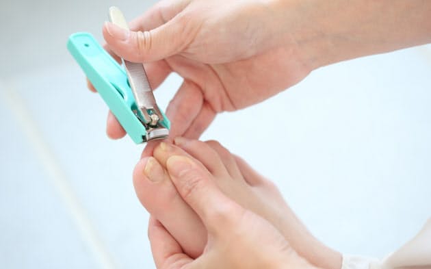 巻き爪 食い込んだ爪 カールしないよう爪を広げる Nikkei Style 巻き爪 食い込んだ爪 カールしないよう爪を広げる Nikkei Style