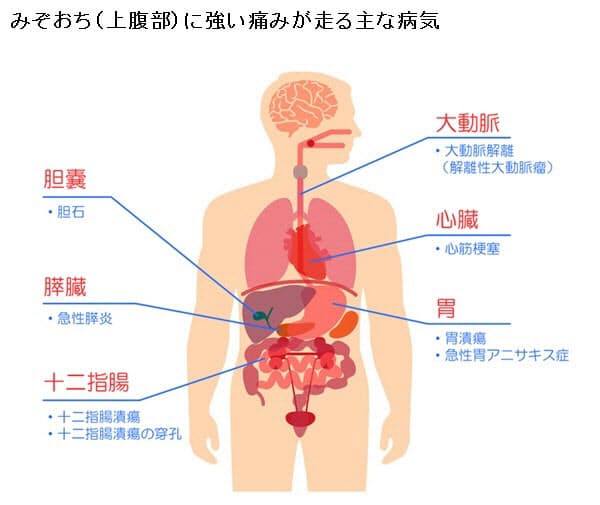 心筋梗塞や大動脈解離でみぞおちが痛むことも 突然みぞおちに強い痛みが 考えられ Nikkei Style