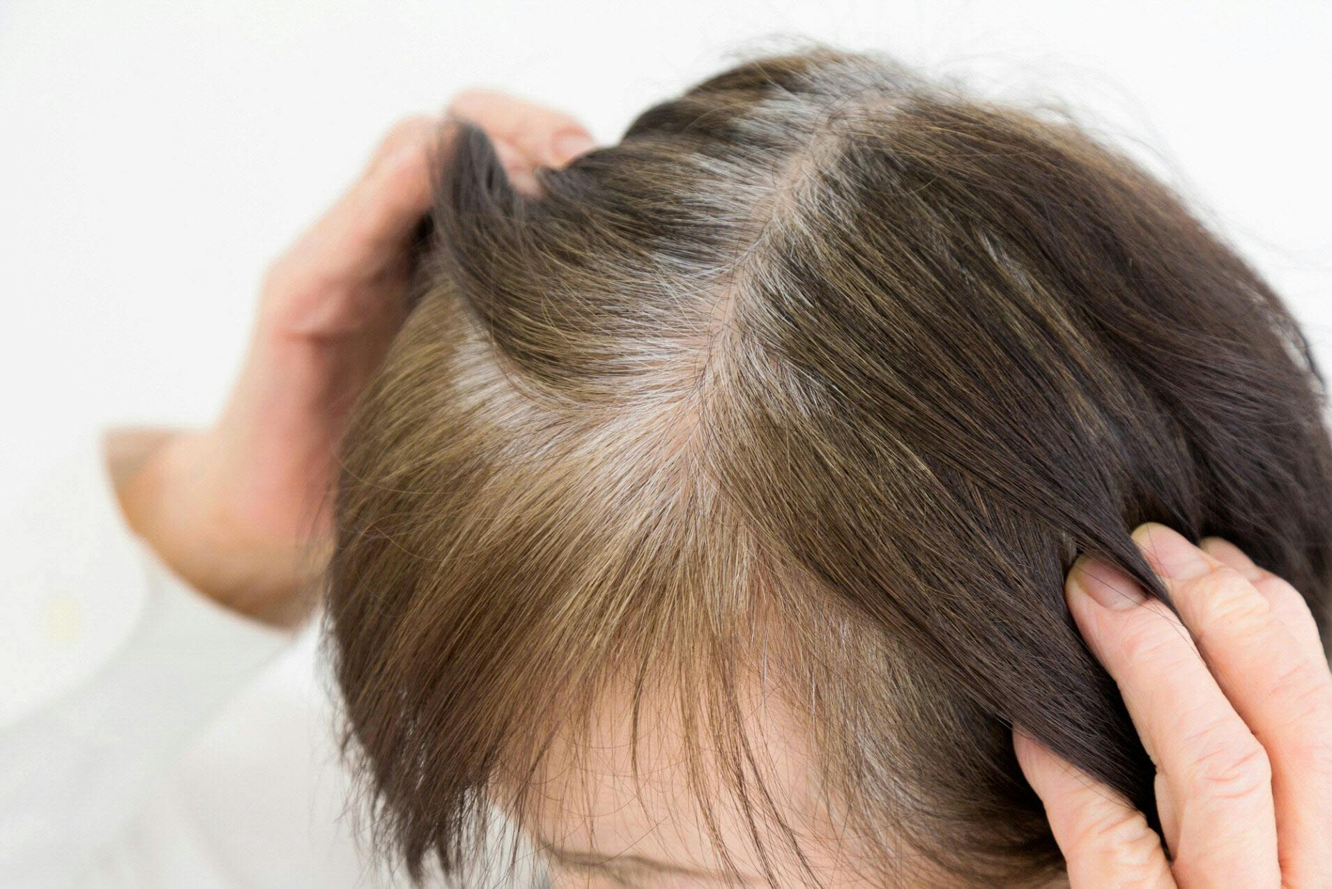 どうして年を取ると白髪ができるの Nikkei Style どうして年を取ると白髪ができるの Nikkei Style