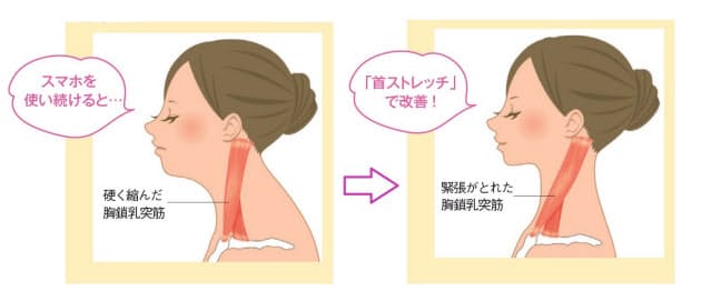 スマホ首」ストレッチ 肩こり・首こり・猫背も解消｜WOMAN SMART ...