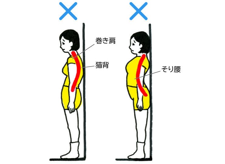 女性に多いのは そり腰 男性は 猫背 その腰痛 肩こり 膝痛 悪い歩き方 Nikkei Style