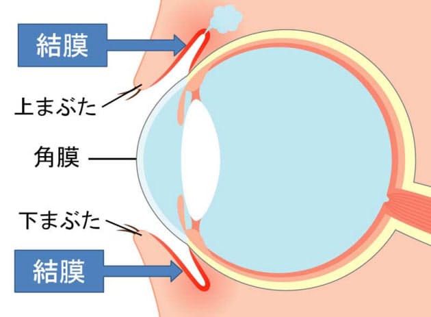 花粉症の目のかゆみ 人工涙液と目薬の二刀流で Nikkei Style 花粉症の目のかゆみ 人工涙液と目薬の二刀流で Nikkei Style
