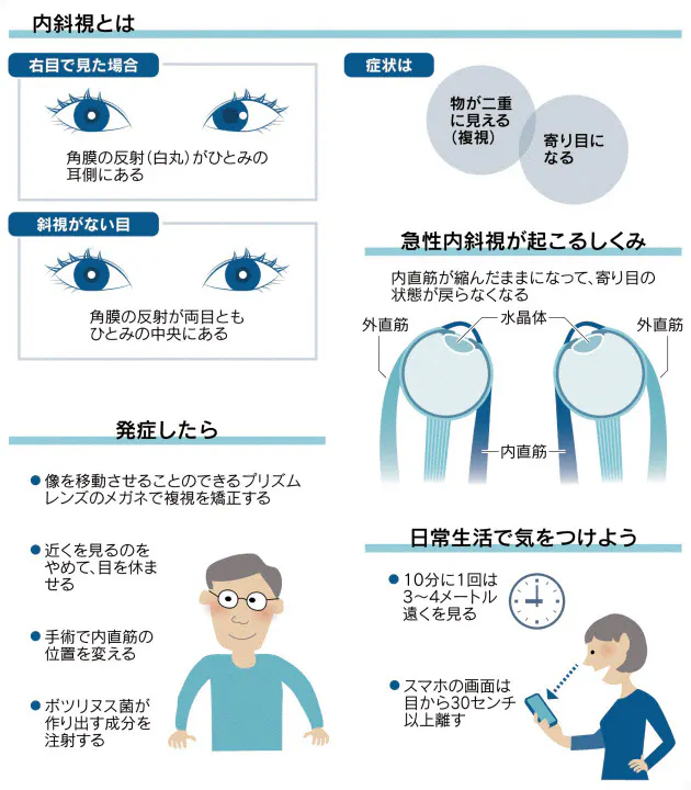 vi 1439 急性内斜視にご用心 スマホ使い過ぎ見直しを ミッキー ことばのレシピ無限大