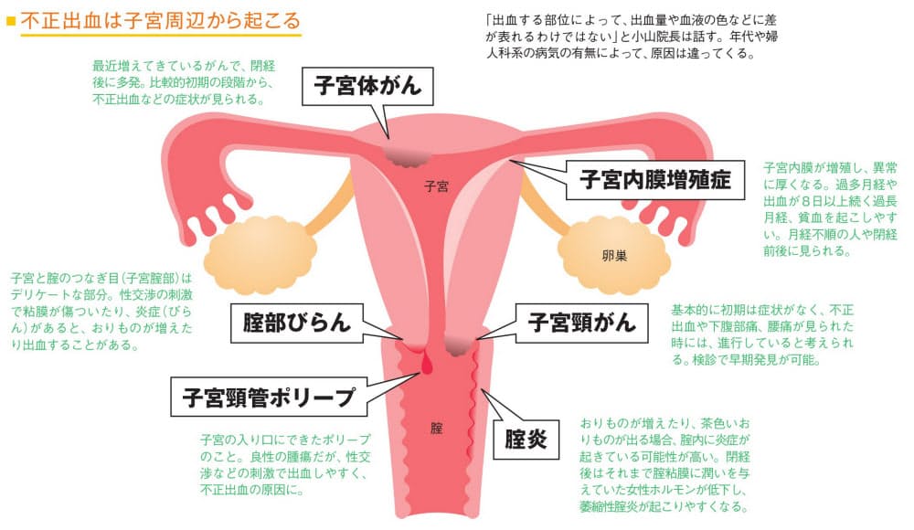 閉経 後 の 出血 異常 なし