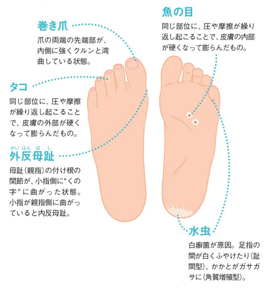 足のどこを見る 元気に歩き続けるポイント5つ Woman Smart Nikkei Style
