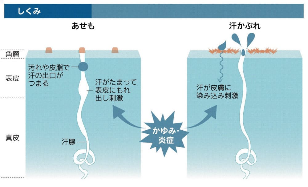 汗 かぶれ 対策