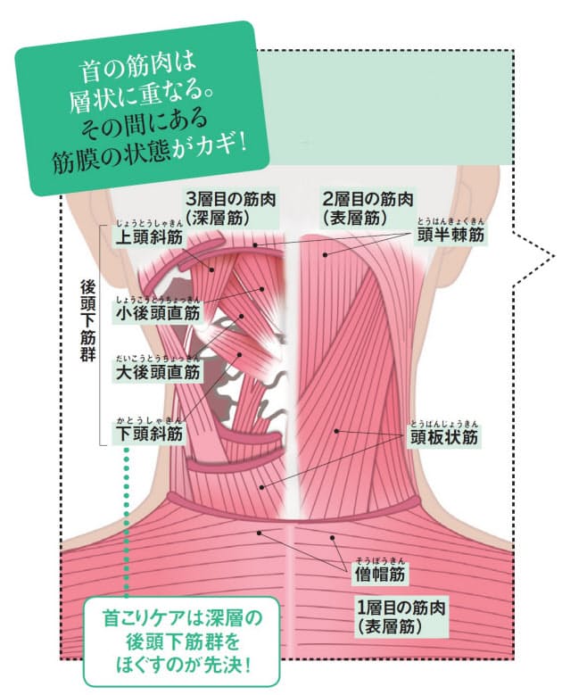 こり 首