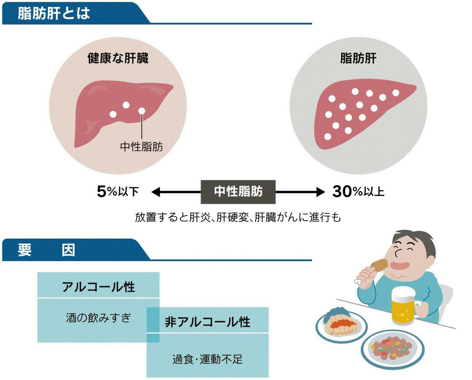 脂肪 肝 と は