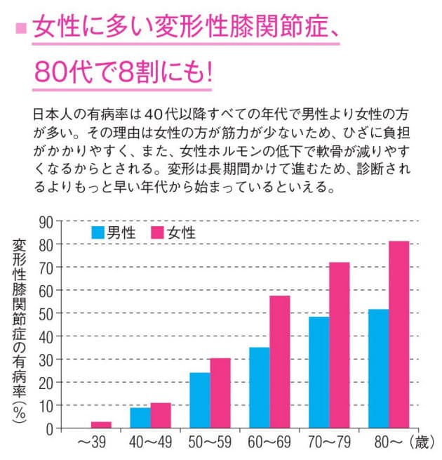 膝の痛みは関節変形のサイン 4つの兆候あれば受診 Nikkei Style 膝の痛みは関節変形のサイン 4つの兆候あれば受診 Nikkei Style