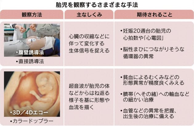 胎児の健康チェック 素早く正確に 心電図や超音波で Nikkei Style