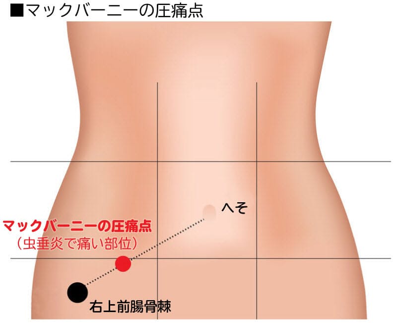 下 腹部 痛み