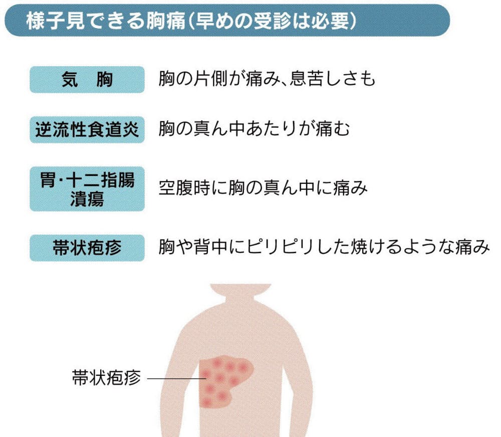胸の痛み 激しい 広範囲ならすぐ受診 肩や喉も注意 Nikkei Style
