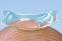 眼内コンタクトレンズは手術で一度入れたら取り外す必要がない=スター・ジャパン提供 眼内コンタクトレンズは手術で一度入れたら取り外す必要がない=スター・ジャパン提供