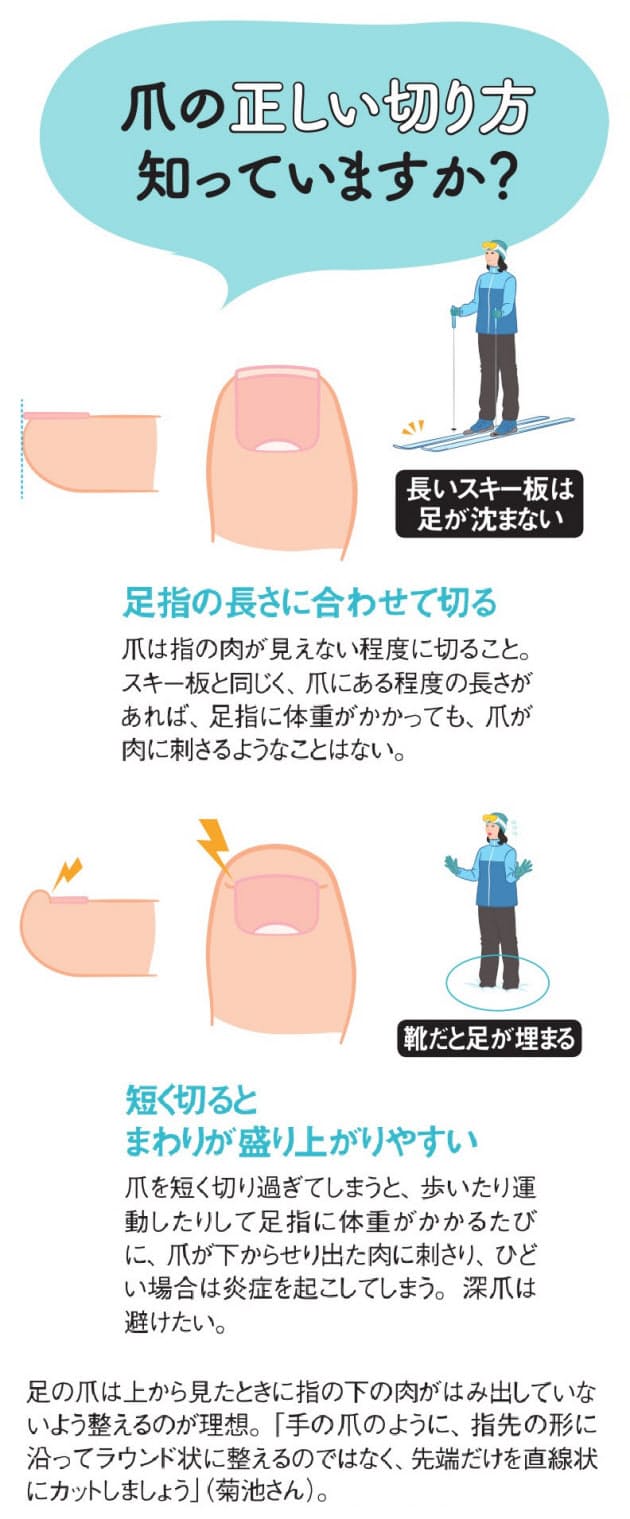 巻き爪 食い込む爪 歩き方や爪の切り方変えてみよう Nikkei Style