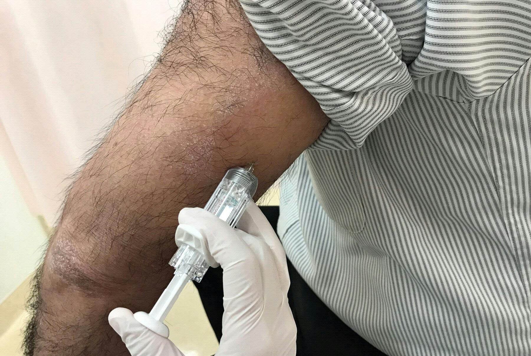 アトピー新薬 自宅で手軽に注射 かゆみの原因抑える Nikkei Style アトピー新薬 自宅で手軽に注射 かゆみの原因抑える Nikkei Style