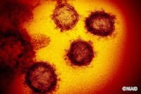 既存のコロナウイルスのように、新型コロナウイルスも夏になると流行は収まる?(C)NIAID 既存のコロナウイルスのように、新型コロナウイルスも夏になると流行は収まる?(C)NIAID