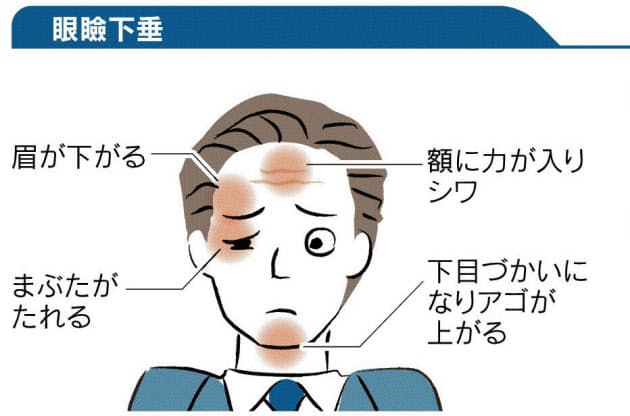 原因 目 ピクピク 目がピクピクする(下まぶた)原因や対処法など治し方は？何か病気なのか？